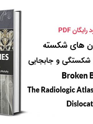کتاب استخوان های شکسته : اطلس رادیولوژیکی شکستگی ها و جابجایی ها