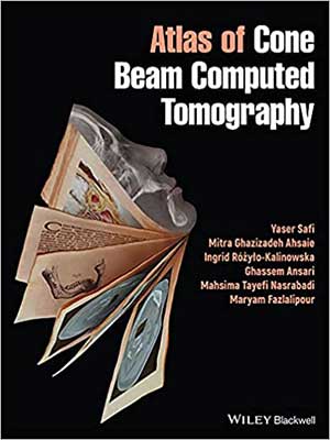 دانلود کتاب اطلس توموگرافی کامپیوتری پرتو مخروطی Atlas of Cone Beam Computed Tomography