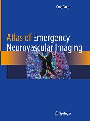 دانلود کتاب اطلس تصویربرداری اورژانسی عصبی-عروقی Atlas of Emergency Neurovascular Imaging 2020