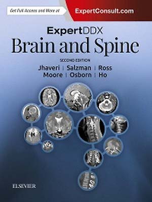 دانلود کتاب مغز و ستون فقرات 2017 ExpertDDx: Brain and Spine