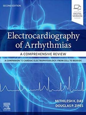دانلود کتاب بررسی جامع الکتروکاردیوگرافی آریتمی قلبی 2021 Electrocardiography of Arrhythmias: A Comprehensive Review