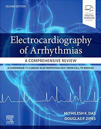 دانلود کتاب بررسی جامع الکتروکاردیوگرافی آریتمی قلبی 2021 Electrocardiography of Arrhythmias: A Comprehensive Review