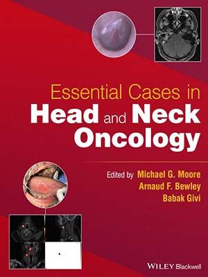 دانلود کتاب موارد ضروری در انکولوژی سر و گردن 2022 Essential Cases in Head and Neck Oncology