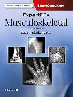 دانلود کتاب ExpertDDx: عضلانی اسکلتی 2017 ExpertDDx: Musculoskeletal