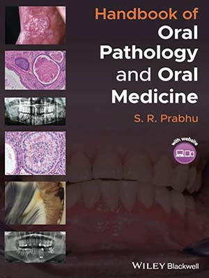 دانلود کتاب راهنمای آسیب شناسی دهان و دهان 2021 Handbook of Oral Pathology and Oral Medicine
