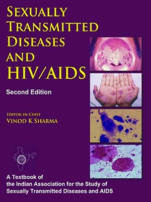 دانلود کتاب بیماری های مقاربتی و اچ آی وی/ایدز 2009 Sexually Transmitted Diseases and HIV/AIDS