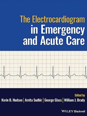دانلود کتاب الکتروکاردیوگرام در مراقبت های اورژانسی و حاد 2023 The Electrocardiogram in Emergency and Acute Care