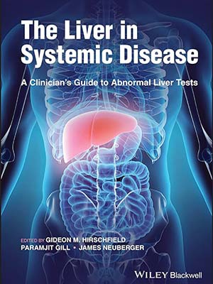 دانلود کتاب کبد در بیماری سیستمیک 2023 The Liver in Systemic Disease: A Clinician’s Guide to Abnormal Liver Tests