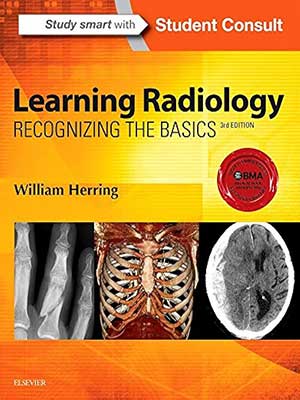 دانلود کتاب یادگیری رادیولوژی: شناخت مبانی 2015 Learning Radiology: Recognizing the Basics