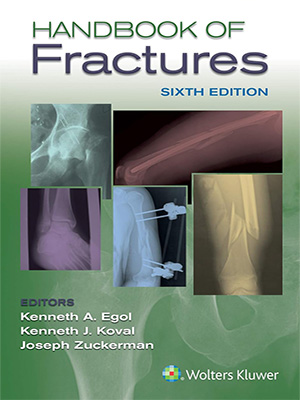 دانلود کتابچه شکستگی ها Handbook of Fractures