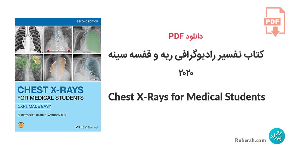 دانلود کتاب تفسیر رادیوگرافی ریه و قفسه سینه Chest X-Rays for Medical Students: CXRs Made Easy