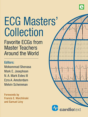 دانلود کتاب تفسیر حرفه ای نوار قلب ECG Masters Collection: Favorite ECGs from Around the World