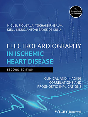 دانلود کتاب الکتروکاردیوگرافی در بیماری ایسکمیک قلب Electrocardiography in Ischemic Heart Disease