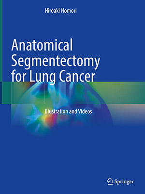 دانلود کتاب سگمنکتومی تشریحی برای سرطان ریه Anatomical Segmentectomy for Lung Cancer