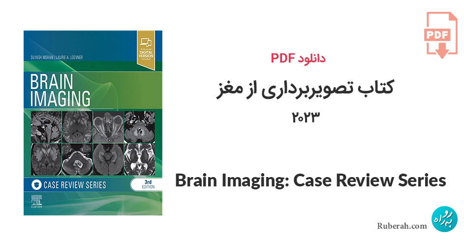 دانلود کتاب تصویربرداری از مغز Brain Imaging: Case Review Series