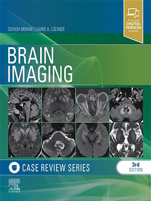 دانلود کتاب تصویربرداری از مغز Brain Imaging: Case Review Series