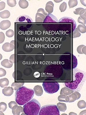 دانلود کتاب راهنمای مورفولوژی هماتولوژی کودکان Guide to Paediatric Haematology Morphology
