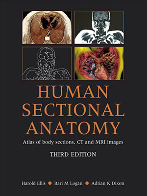 دانلود کتاب آناتومی مقطعی انسان Human Sectional Anatomy: Atlas of Body Sections, CT and MRI Images