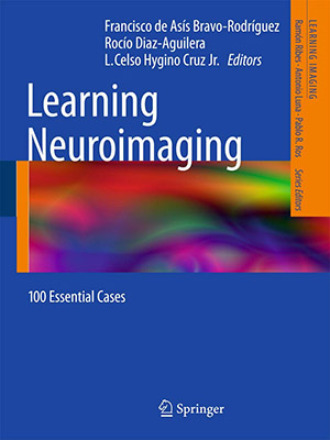 دانلود کتاب یادگیری تصویربرداری عصبی: 100 مورد ضروری Learning Neuroimaging: 100 Essential Cases