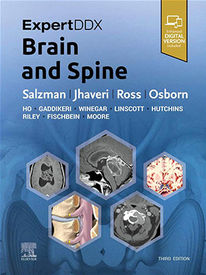 دانلود کتاب مغز و ستون فقرات 2023 ExpertDDx: Brain and Spine