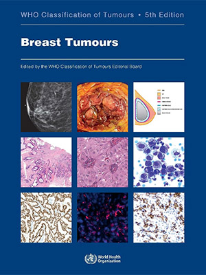 دانلود کتاب طبقه بندی تومورهای سینه Breast Tumours: Who Classification of Tumours