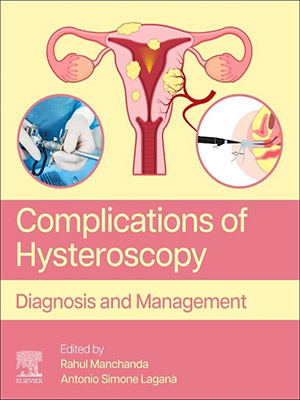 دانلود کتاب عوارض هیستروسکوپی Complications of Hysteroscopy: Diagnosis and Management