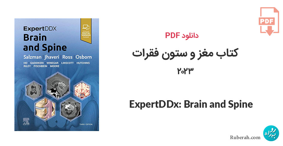 دانلود کتاب مغز و ستون فقرات 2023 ExpertDDx: Brain and Spine