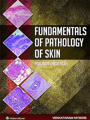 دانلود کتاب مبانی آسیب شناسی پوست Fundamentals of Pathology of Skin