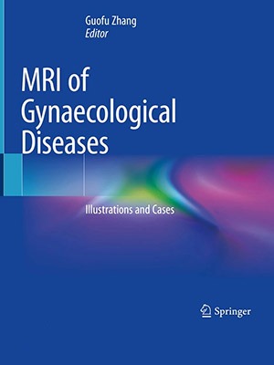 دانلود تصاویر و موارد پزشکی در MRI بیماری های زنان MRI of Gynaecological Diseases: Illustrations and Cases