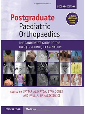 دانلود کتاب راهنمای داوطلبان برای آزمون فوق لیسانس ارتوپدی اطفال Postgraduate Paediatric Orthopaedics: The Candidate's Guide to the FRCS (TrAndOrth) Examination