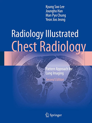 دانلود کتاب رادیولوژی مصور قفسه سینه Radiology Illustrated: Chest Radiology