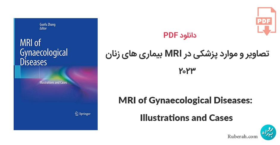 دانلود تصاویر و موارد پزشکی در MRI بیماری های زنان MRI of Gynaecological Diseases: Illustrations and Cases