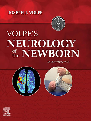 دانلود کتاب نورولوژی نوزادان والپه 2024 Volpe's Neurology of the Newborn