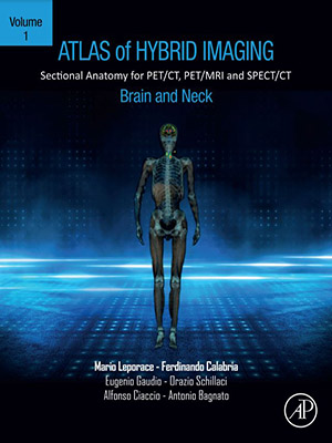 دانلود کتاب اطلس تصویربرداری ترکیبی از مغز و گردن Atlas of Hybrid Imaging Sectional Anatomy for PET/CT, PET/MRI and SPECT/CT Vol.1