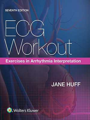 دانلود کتاب تمرین نوار قلب: تفسیر آریتمی قلب ECG Workout: Exercises in Arrhythmia Interpretation