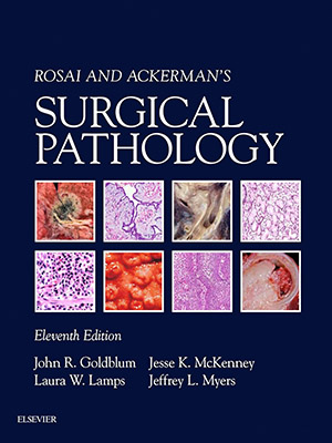 دانلود کتاب آسیب شناسی جراحی روزای و آکرمن Rosai and Ackerman's Surgical Pathology