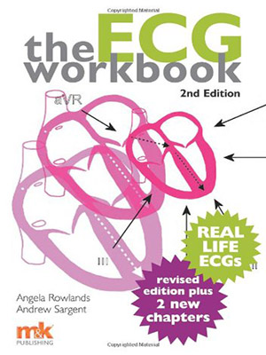 دانلود کتاب کار ECG (تست نوار قلب یا الکتروکاردیوگرام) The ECG Workbook