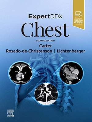 دانلود کتاب ExpertDDx سینه 2020 ExpertDDx: Chest