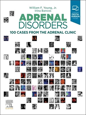 دانلود کتاب اختلالات آدرنال: بررسی 100 مورد اختلال Adrenal Disorders: 100 Cases from the Adrenal Clinic