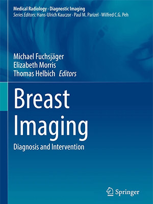 دانلود کتاب تصویربرداری از سینه Breast Imaging: Diagnosis and Intervention