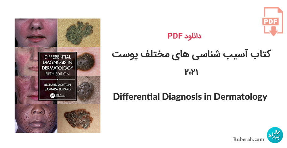 دانلود کتاب آسیب شناسی های مختلف پوست Differential Diagnosis in Dermatology