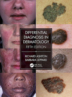 دانلود کتاب آسیب شناسی های مختلف پوست Differential Diagnosis in Dermatology