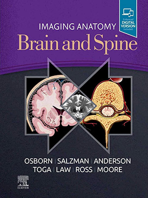 دانلود کتاب تصویربرداری آناتومی مغز و ستون فقرات Imaging Anatomy Brain and Spine