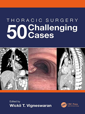 دانلود کتاب جراحی قفسه سینه: 50 مورد چالش برانگیز Thoracic Surgery: 50 Challenging Cases