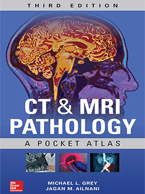 دانلود کتاب آسیب شناسی سی تی و ام آر آی 2018 CT & MRI Pathology: A Pocket Atlas