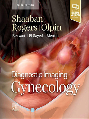 دانلود کتاب تصویربرداری تشخیصی: بیماری های زنان 2021 Diagnostic Imaging: Gynecology