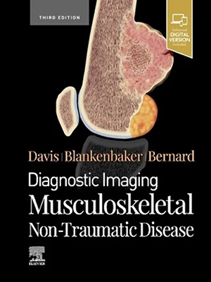 دانلود کتاب تصویربرداری تشخیصی: بیماری اسکلتی عضلانی غیرتروماتیک Diagnostic Imaging: Musculoskeletal Non-Traumatic Disease