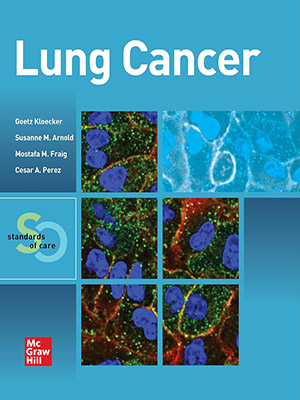 دانلود کتاب سرطان ریه: استانداردهای مراقبت Lung Cancer: Standards of Care