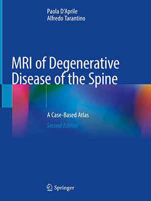 دانلود کتاب ام آر آی (MRI) بیماری دژنراتیو ستون فقرات MRI of Degenerative Disease of the Spine