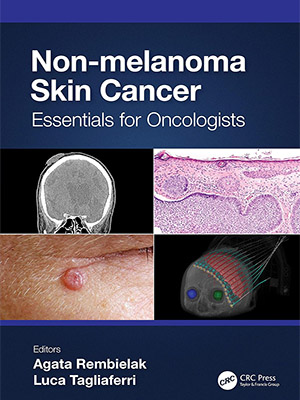 دانلود کتاب سرطان پوست غیر ملانوما Non-melanoma Skin Cancer: Essentials for Oncologists